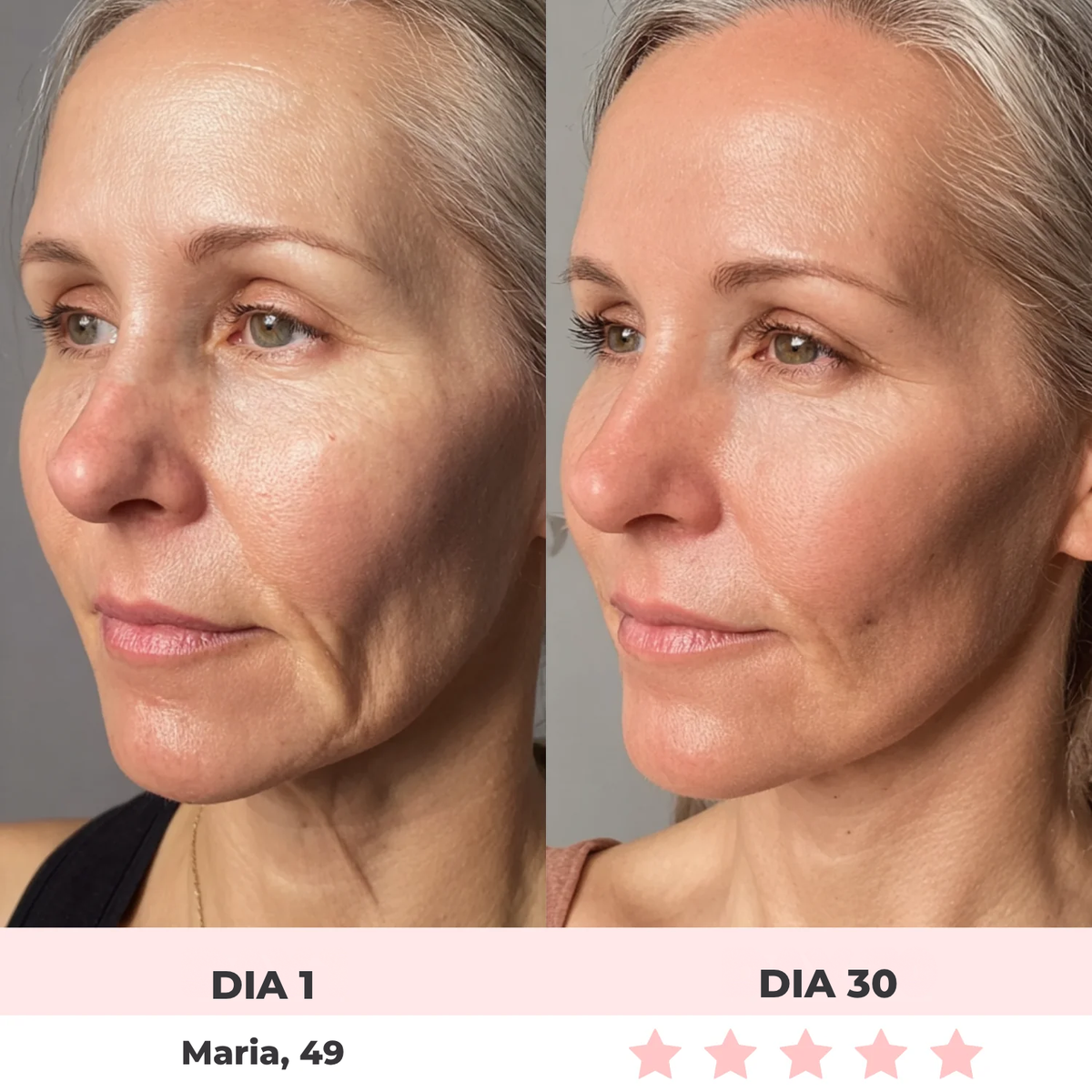 Alluface 7 em 1 - Tratamento facial completo [rugas-flacidez-papada]