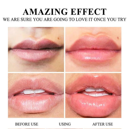 Lip Up - Aumento instantâneo para lábios
