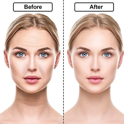 Kit Rejuvene Clean - Adesivos Anti-Rugas das famosas (Reutilizável)