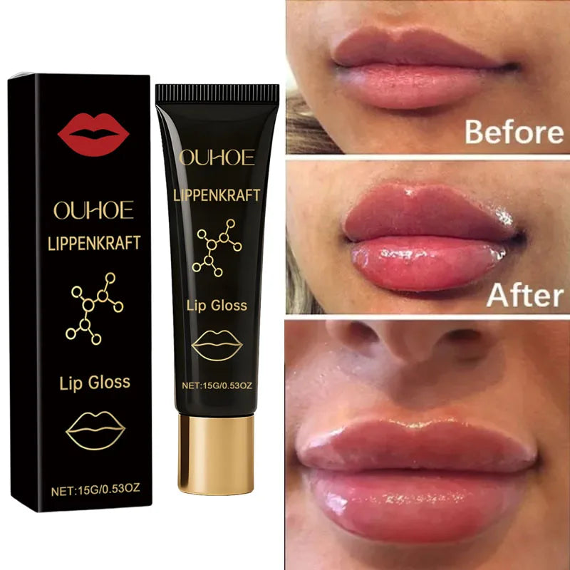 Lip Up - Aumento instantâneo para lábios