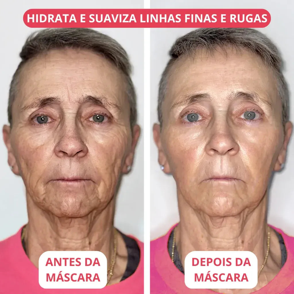Allumask - Máscara de colágeno + ativos do botox