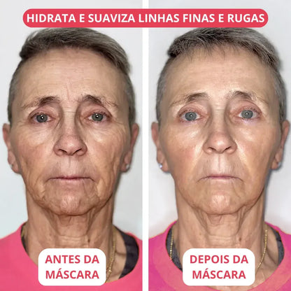 Allumask - Máscara de colágeno + ativos do botox