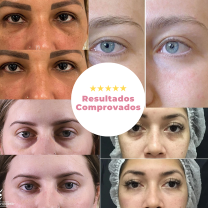 LumiEye - Retinol para área dos olhos [rugas - bolsas - linhas finas]